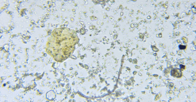 Soil Food Web Analysis conducted by Terra Viva. Microscope analysis.